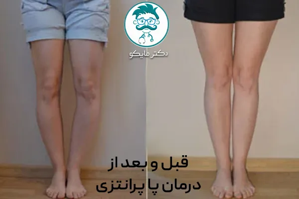 از کجا بفهمیم پا پرانتزی هستیم؟