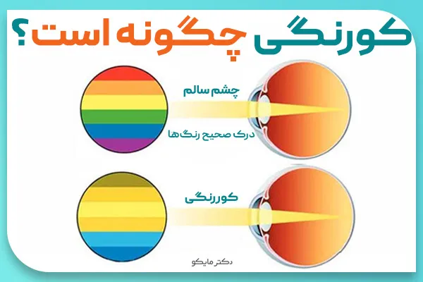 کوررنگی چگونه است؟