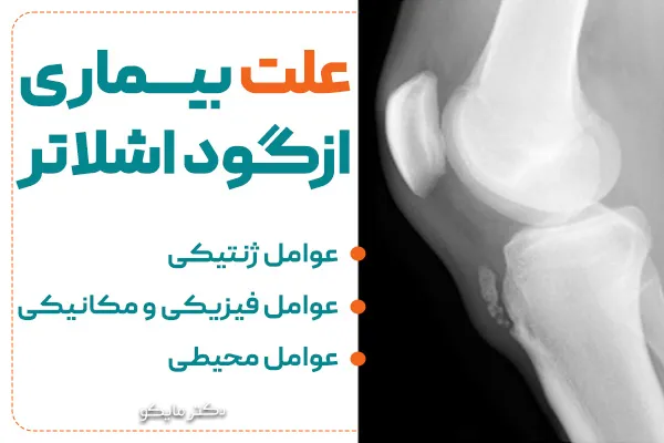 علت بیماری ازگود اشلاتر