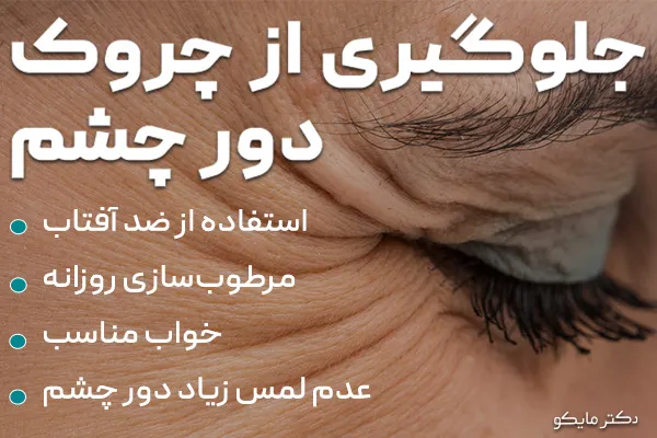 جلوگیری از چروک دور چشم