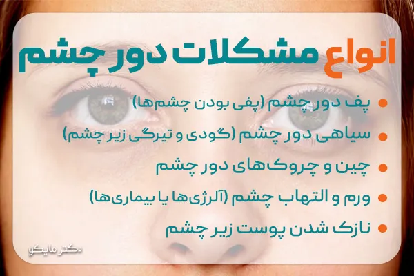 انواع مشکلات دور چشم