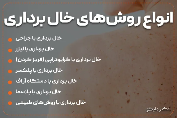 خال برداری با روش‌های مختلف