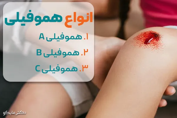 علت هموفیلی چیست؟