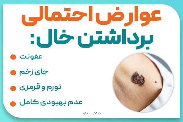 عوارض برداشتن خال صورت