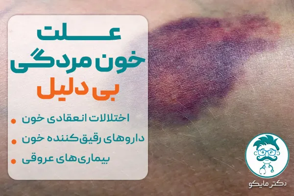 علت خون مردگی بی دلیل