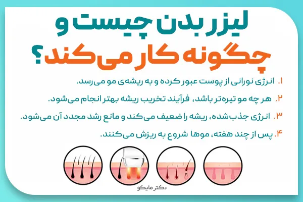 لیزر بدن چیست و چگونه کار می‌کند؟