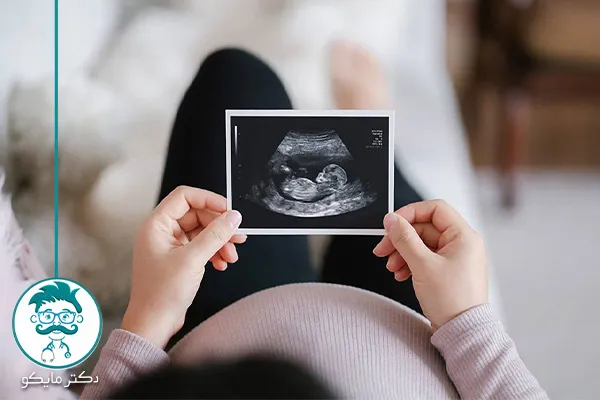 ویتامین A در بارداری