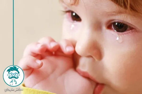 آبریزش چشم نوزاد