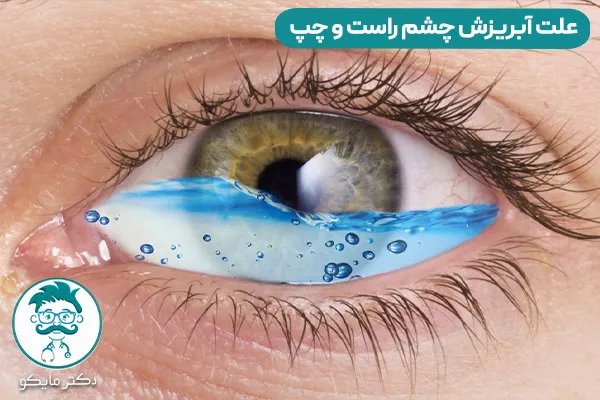 آبریزش چشم