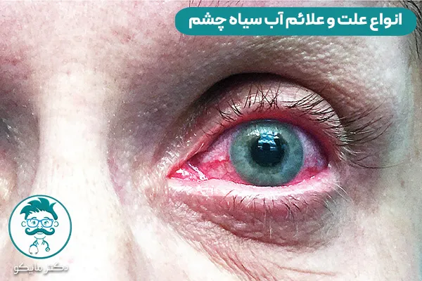 آب سیاه چشم