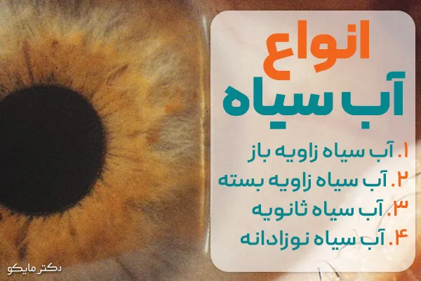 انواع آب سیاه چشم