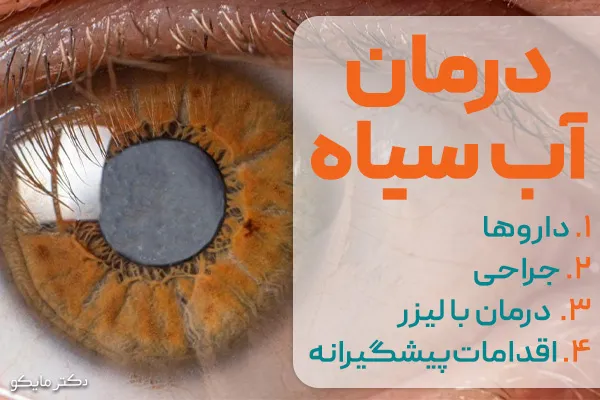 درمان آب سیاه چشم