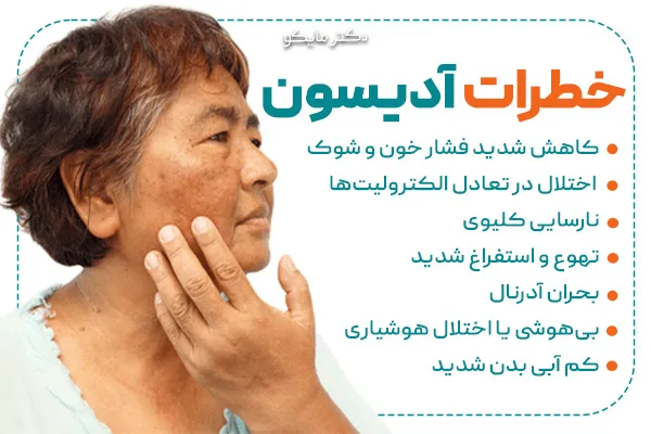 آیا بیماری آدیسون خطرناک است؟