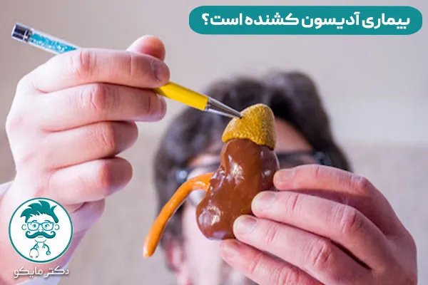 بیماری آدیسون چیست؟