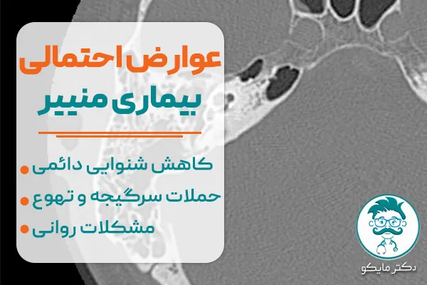 آیا بیماری منییر خطرناک است؟