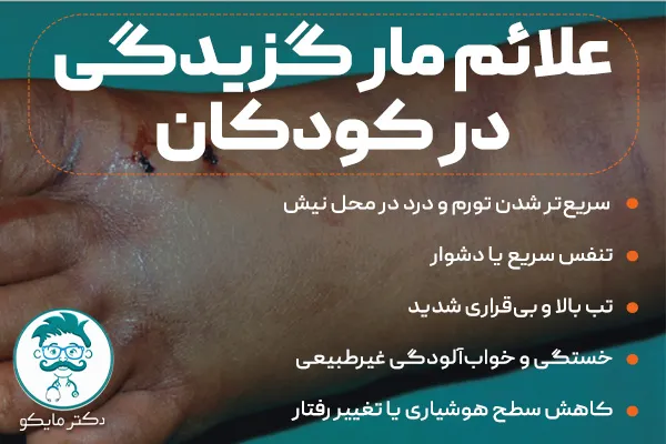 علائم مار گزیدگی در کودکان