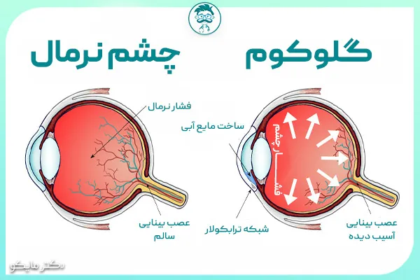 عکس آب سیاه چشم