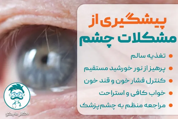 پیشگیری از مشکلات چشمی