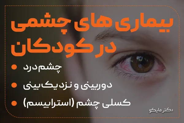بیماری های چشمی کودکان