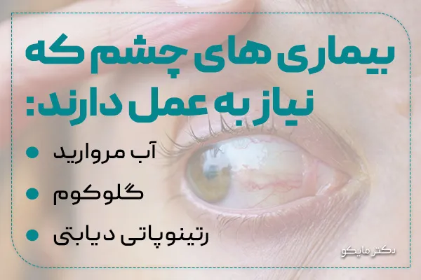 بیماری های چشمی که نیاز به عمل دارند