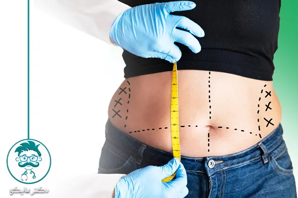 هزینه ابدومینوپلاستی