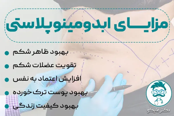 مزایای ابدومینوپلاستی