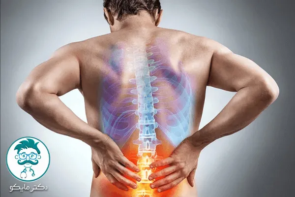 درد عصبی کمر و پا