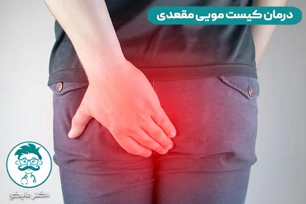 کیست مویی چیست؟ 