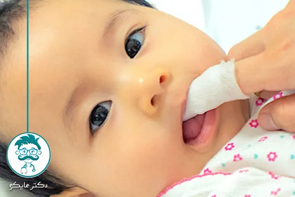 درمان قطعی برفک دهان نوزاد