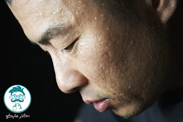 چه زمانی عرق سرد خطرناک است؟