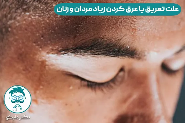 عرق کردن زياد نشانه چيست؟