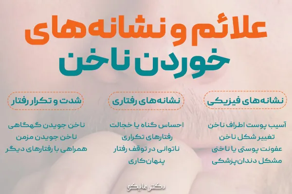 علائم خوردن ناخن چیست؟