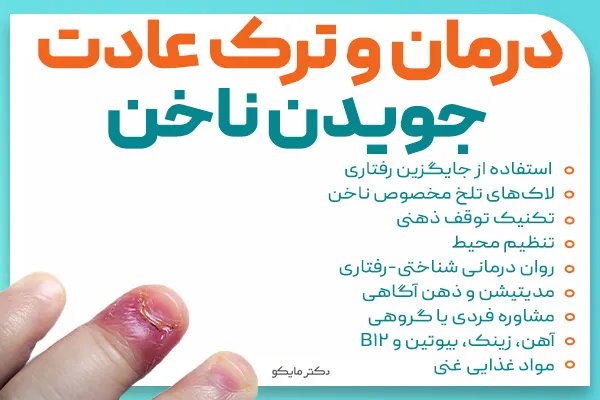 درمان و ترک عادت جویدن ناخن