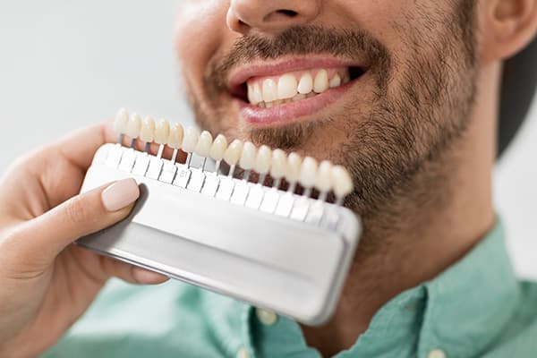 7 مرحله ی اجرای لمینت دندان چیست؟ انواع، قیمت، مزایا و معایب