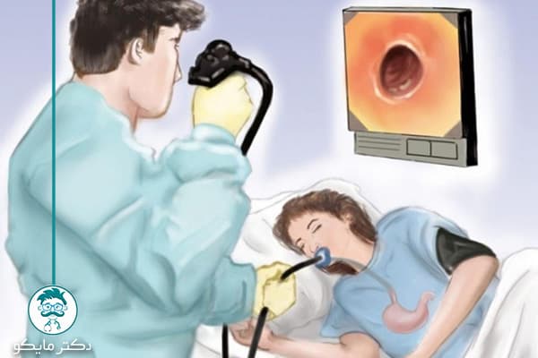 آندوسکوپی معده درد دارد؟