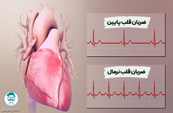 ضربان قلب پایین چه علائمی دارد؟