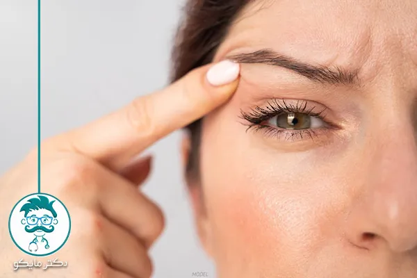 علت افتادگی پلک چشم چیست؟