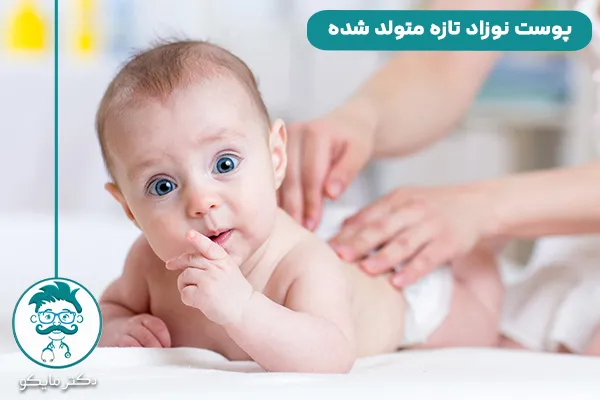 مراقبت از پوست نوزاد