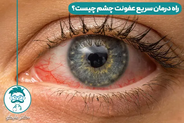 عفونت چشم چیست؟