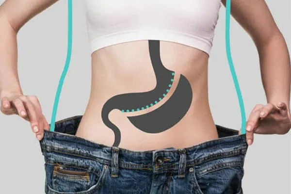 عمل اسلیو معده چیست؟ راهنمای کامل روش های جراحی اسلیو، فواید و عوارض + هزینه عمل معده