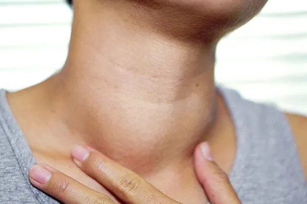 غده تیروئید چیست و کجاست؟ انواع اختلالات و بیماریهای تیروئید