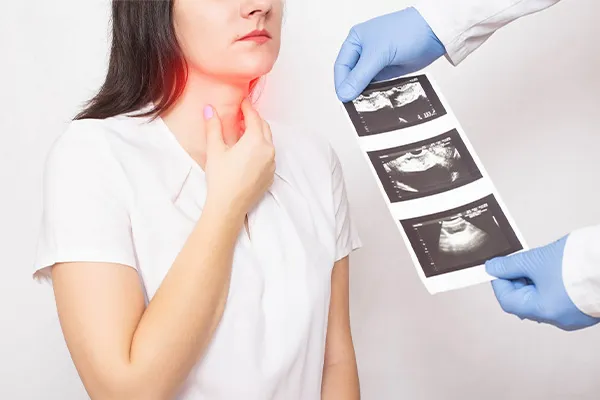 علت کم کاری تیروئید چیست؟ علائم تیروئید کم کار زنان، کودکان و نوزادان، عوارض + درمان سریع هیپوتیروئیدیسم