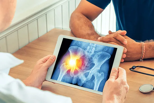 علائم شکستگی لگن چیست؟ علت شکستن لگن سالمندان و جوانان + راه درمان سریع شکستگی لگن