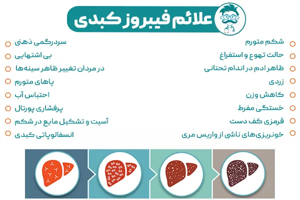 علائم فیبروز کبدی