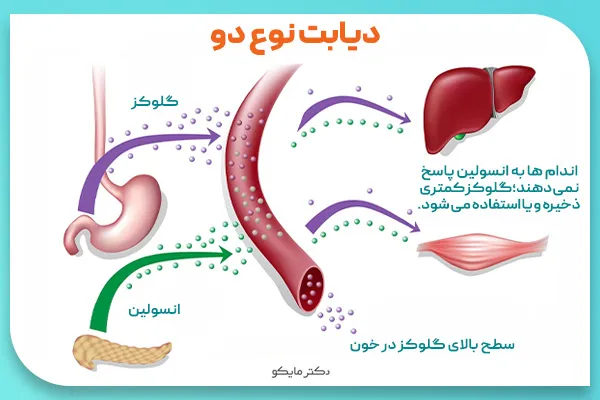 دیابت نوع دو چگونه است؟