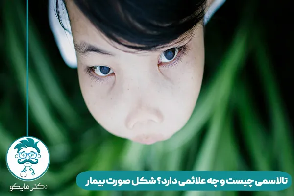 تالاسمی چیست و چه علائمی دارد؟