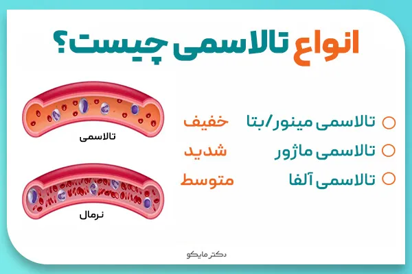 انواع تالاسمی