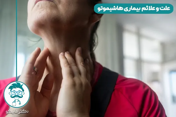 بیماری هاشیموتو چیست؟