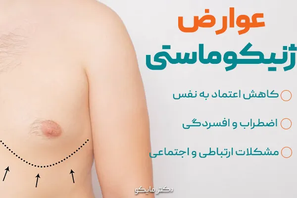عوارض ژنیکوماستی در مردان