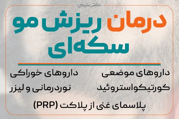 درمان ریزش مو سکه‌ ای چیست؟